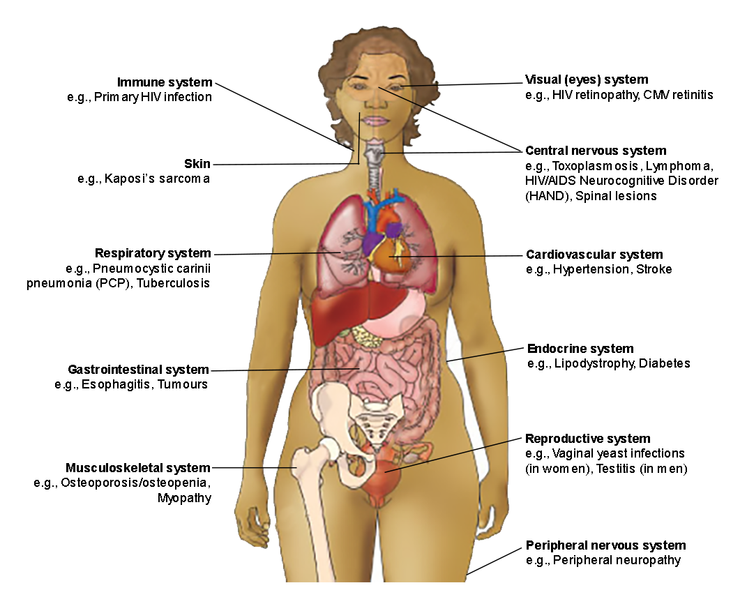 Examples of  diagnoses affecting different body systems in people living with HIV. Read description below.